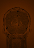 2019-09-05/e45e8dfb7f727793dbd42d24339b5578_1ba246d6b712ceb2a8aaa905c422e202