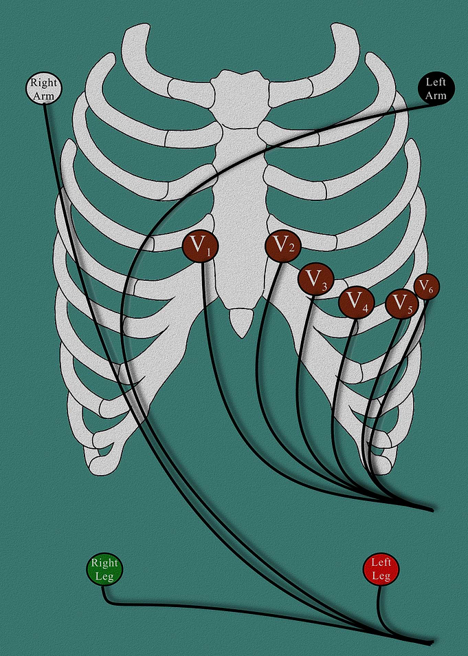 12-Lead EKG poster