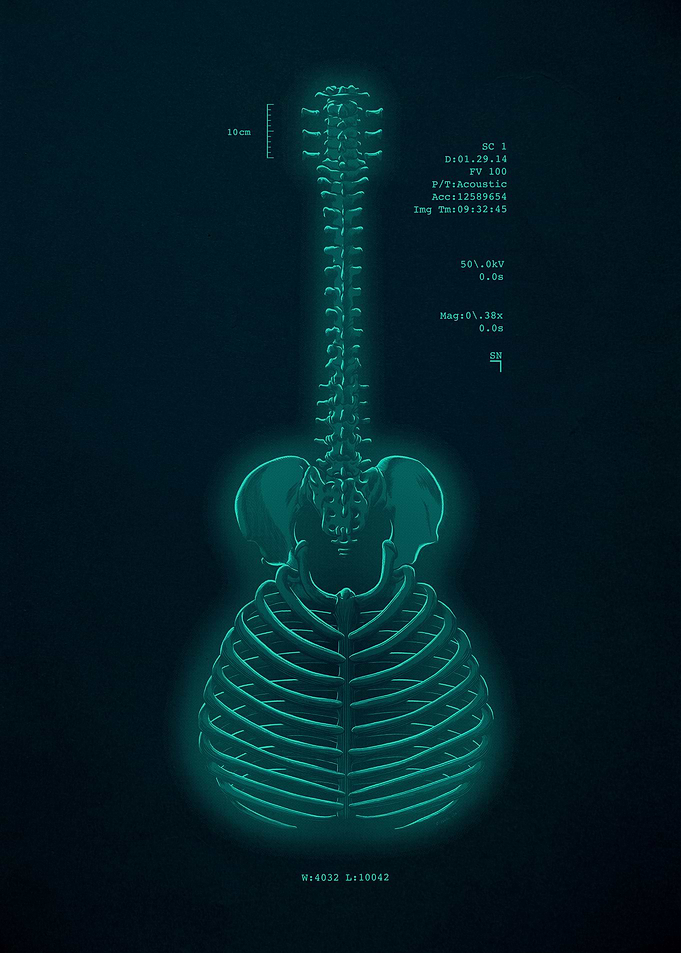 Acoustic X-Ray