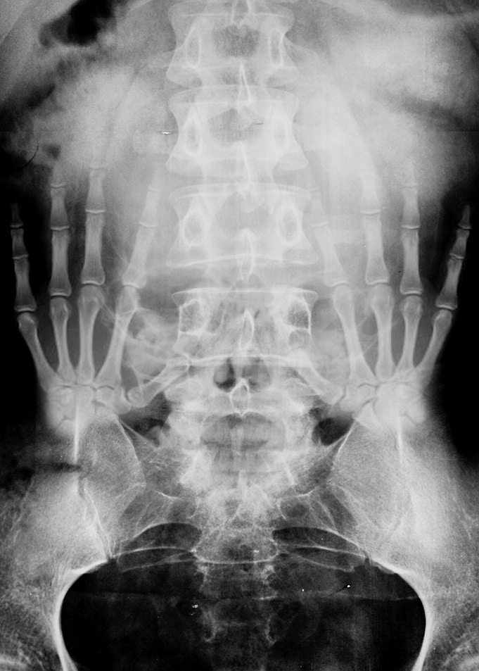 X Ray I