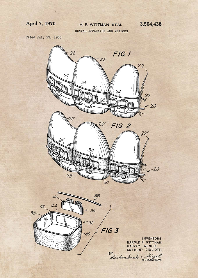 patent art Wittman 1970 Dental apparatus and metho