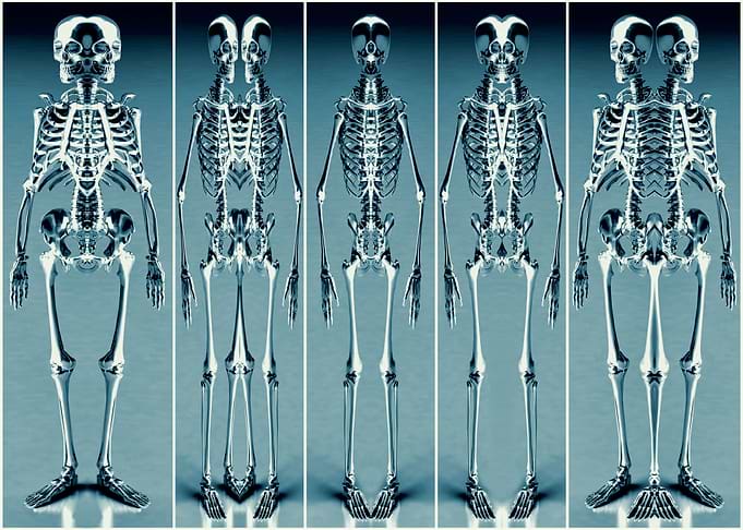 Alien Skeletons