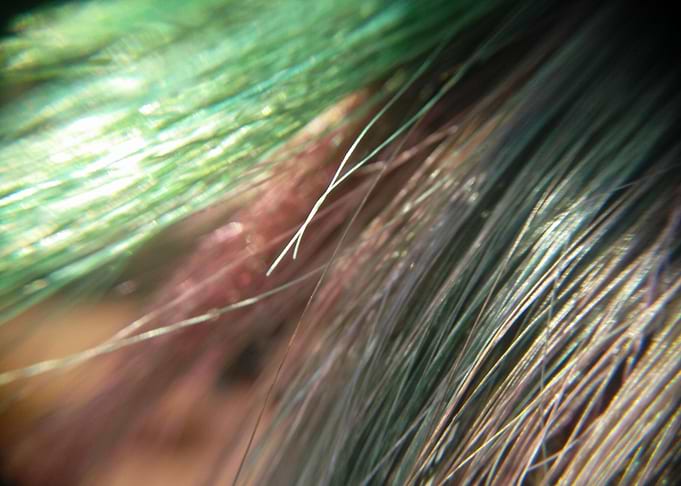 Touches of Green