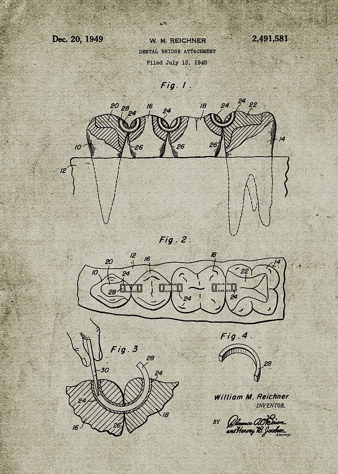 1948 Dental Bridge
