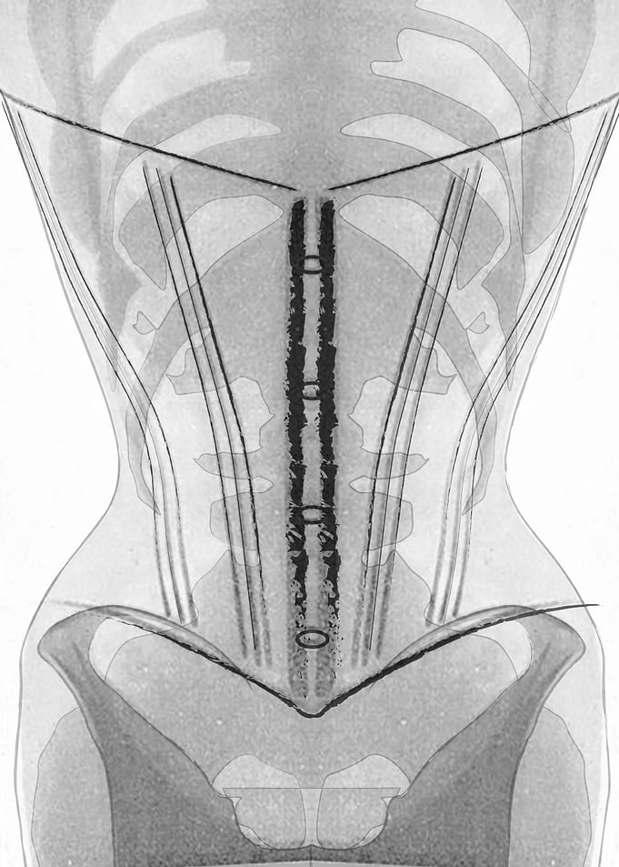 Corset 6 in white