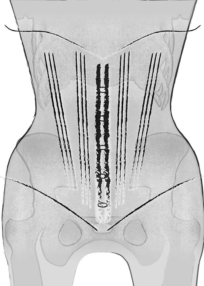 Corset 5 in white