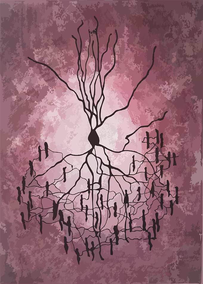 Chandelier Cell