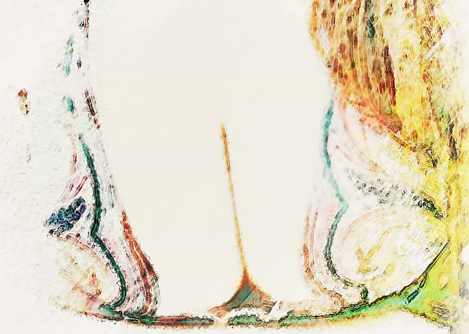 Breast