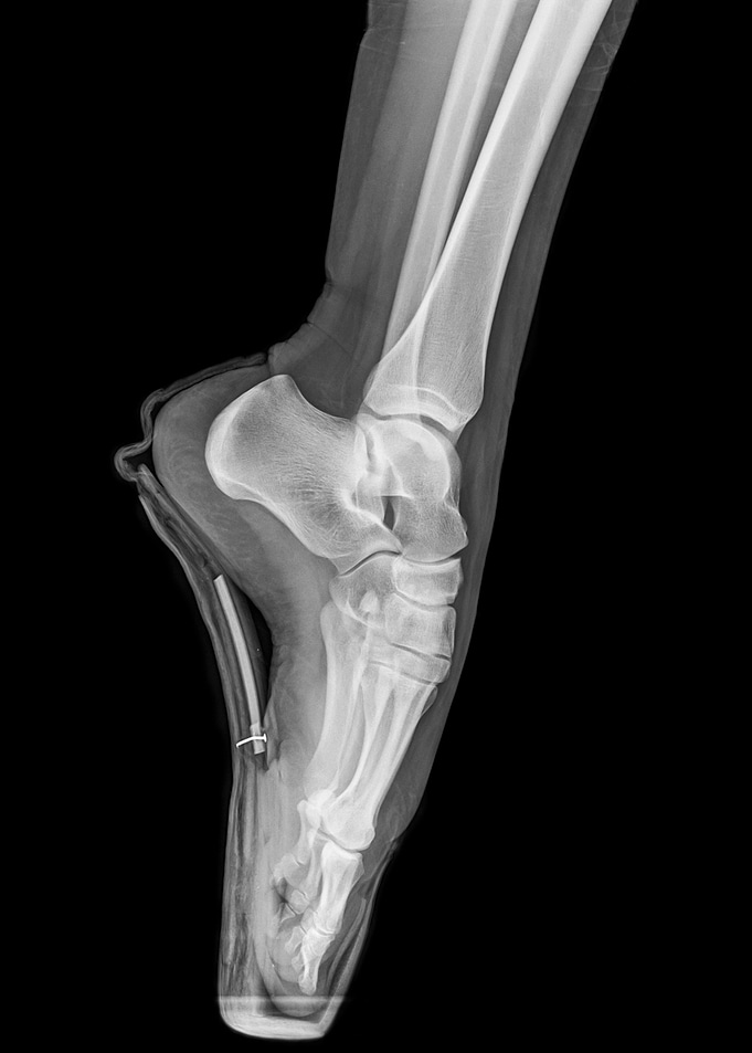x ray of a ballet dancer