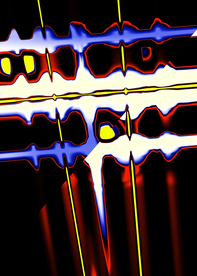 Vocal Track