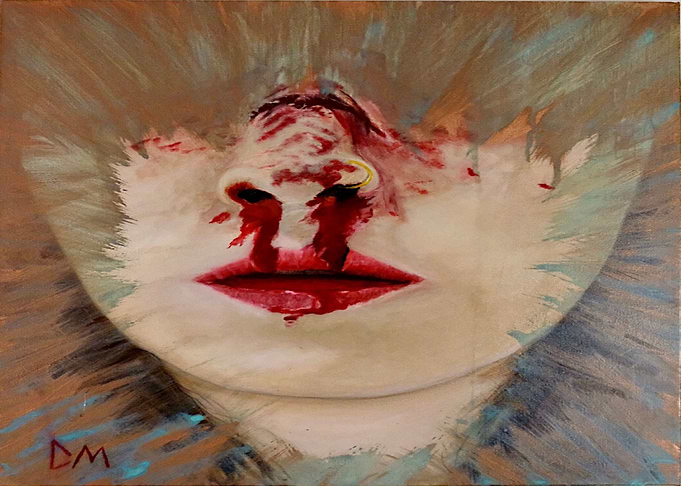 broken nose