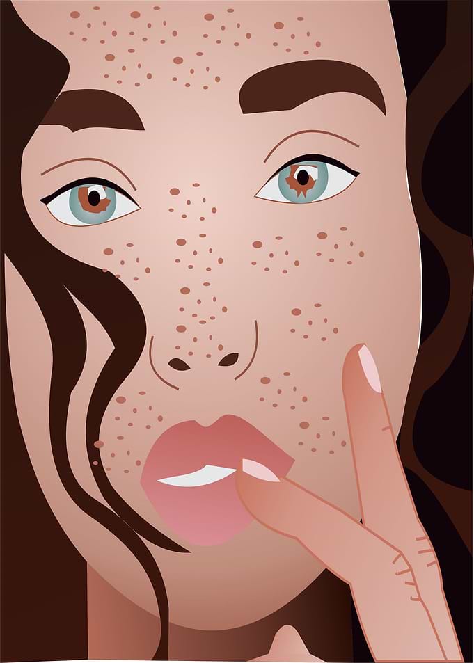 girl with spots