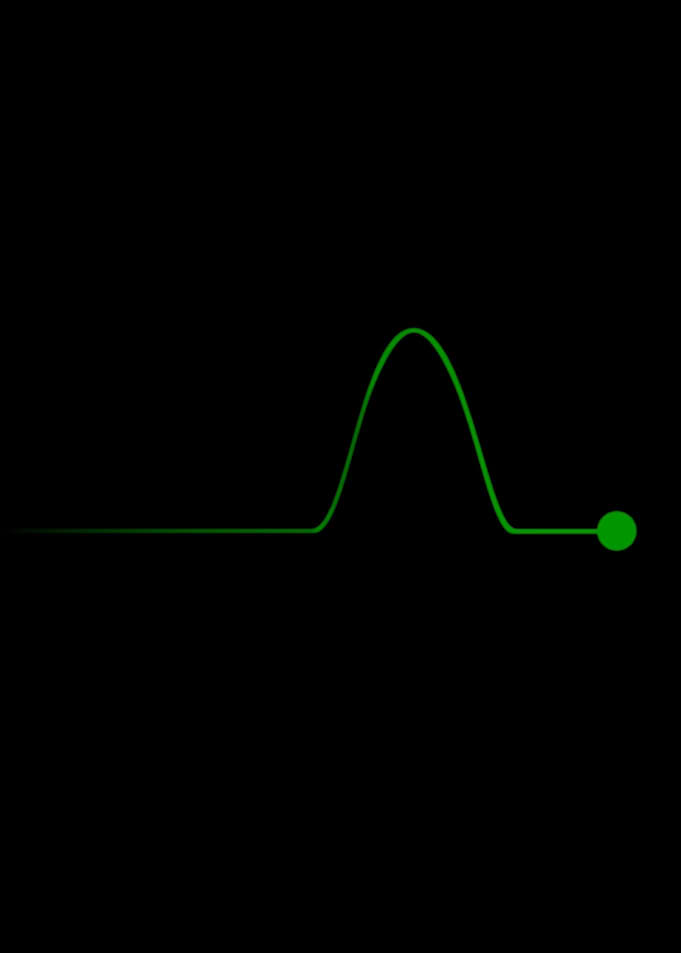 Pulse