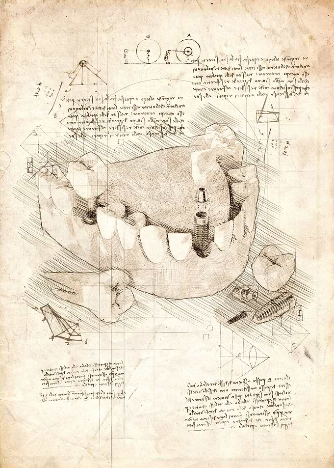 Human Dental Implant