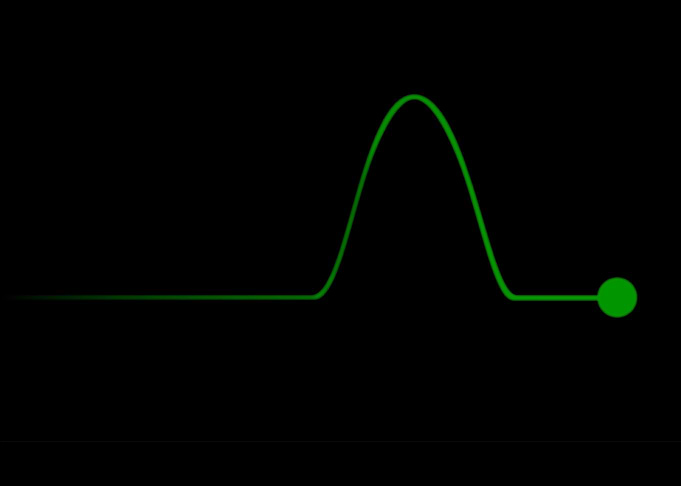 Pulse