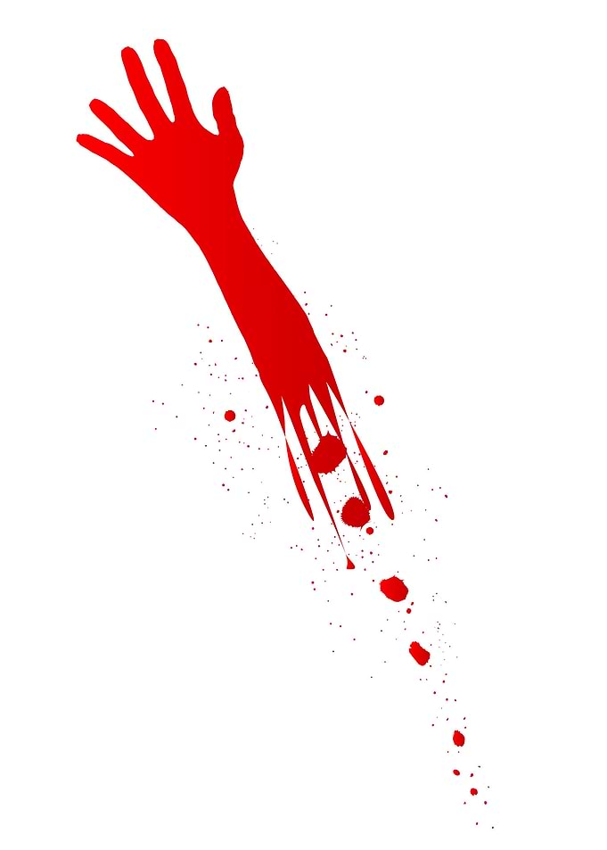 Severed Arm