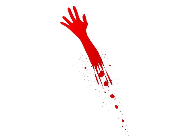 Severed Arm