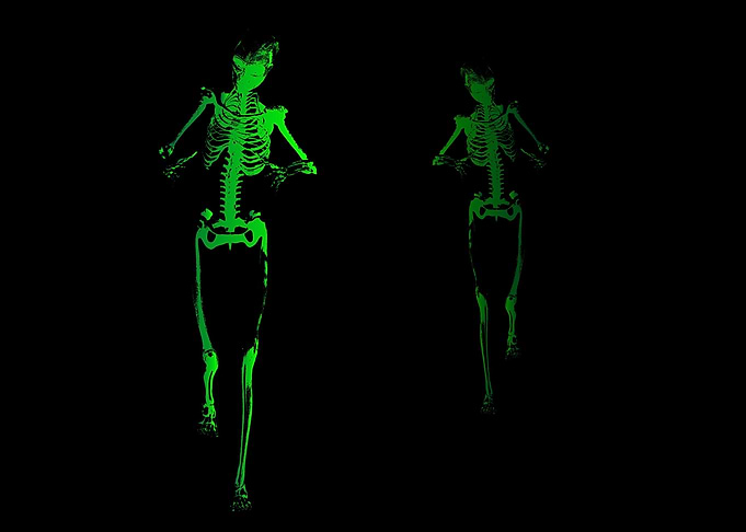 Skeleton Stalker
