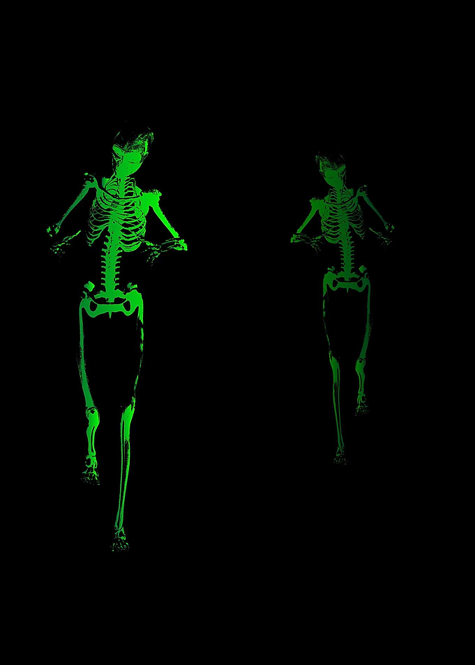 Skeleton Stalker