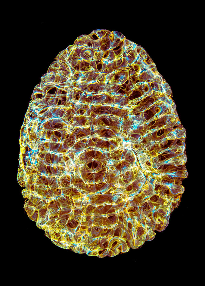 The Golden Egg