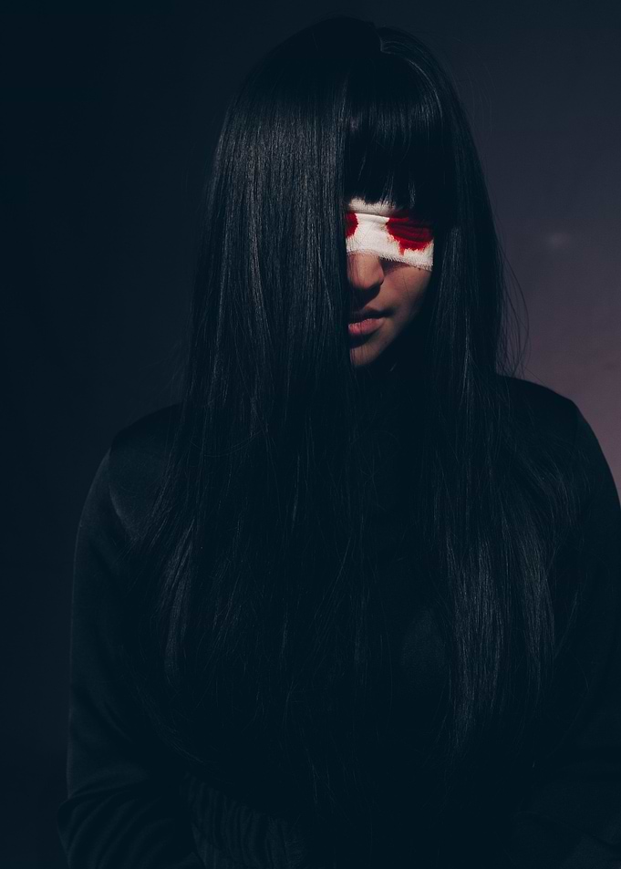 Bloody eyes