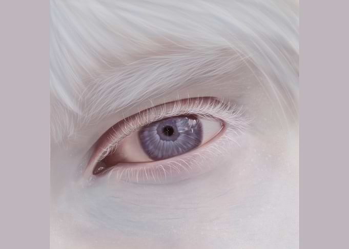 Albino Eye