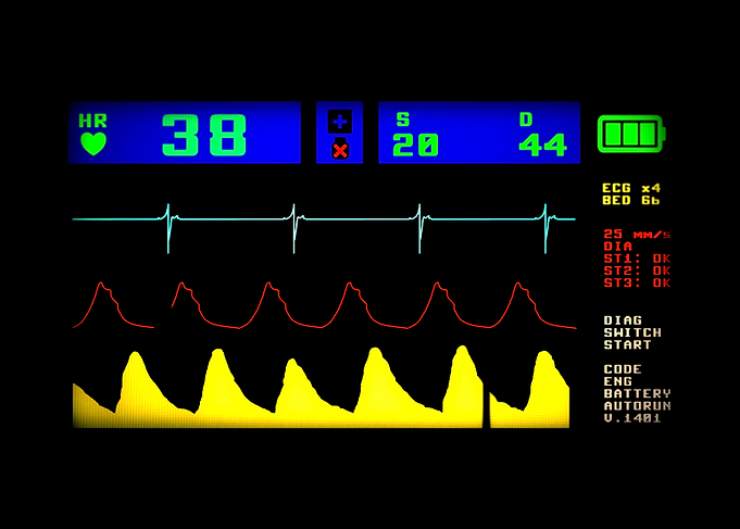 ECG screen simulation