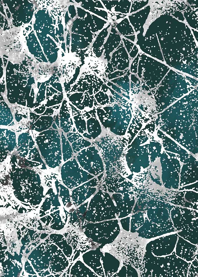 Neural network