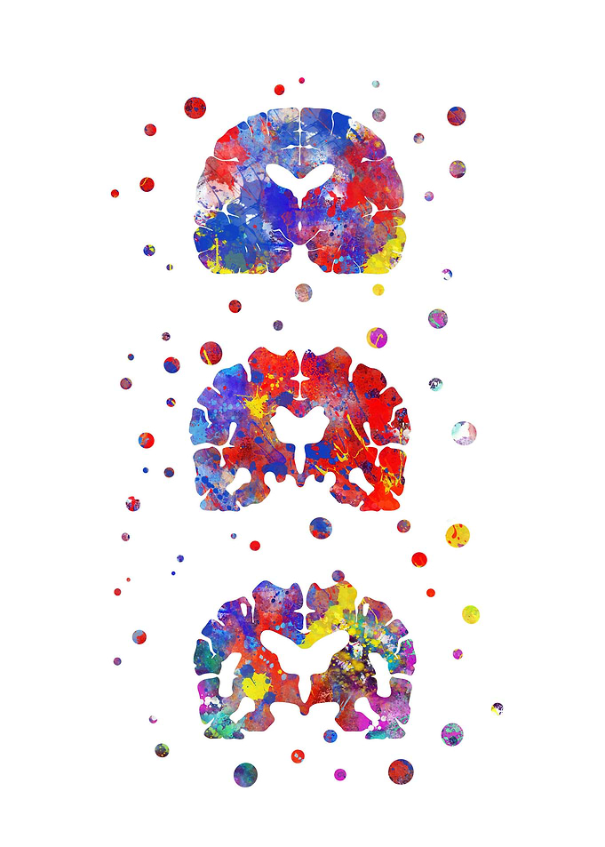 Alzheimers Disease