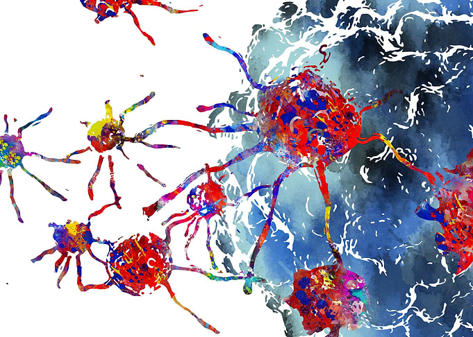 Prostate cancer cells