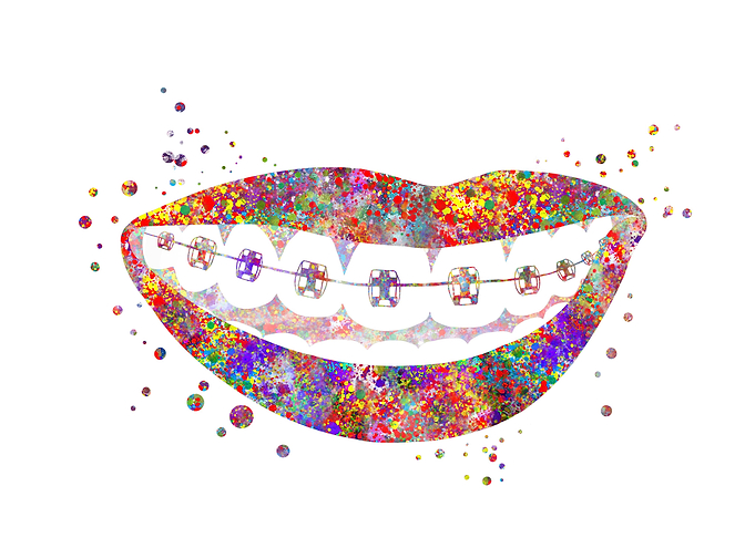 Teeth braces