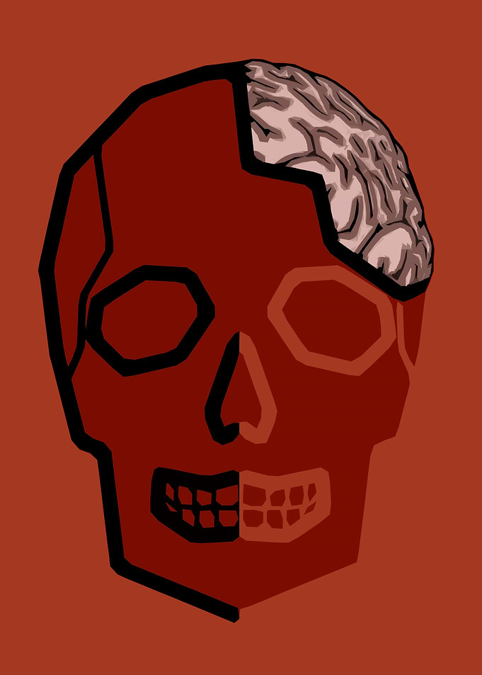 Fractured skull