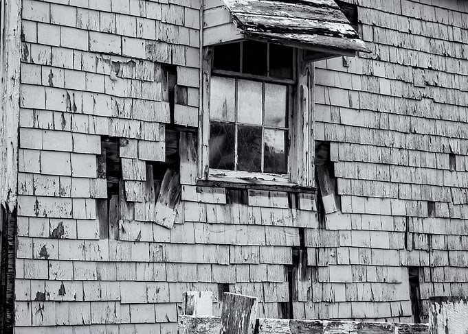 Shingles