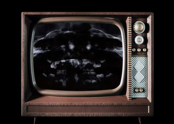 Radiography kid mouth