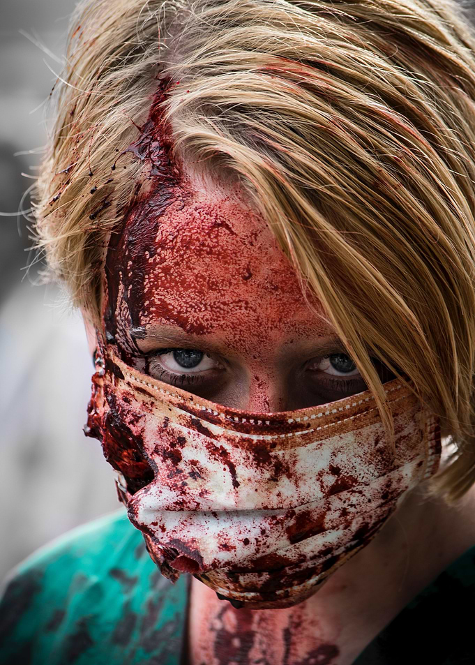 Bloodied face