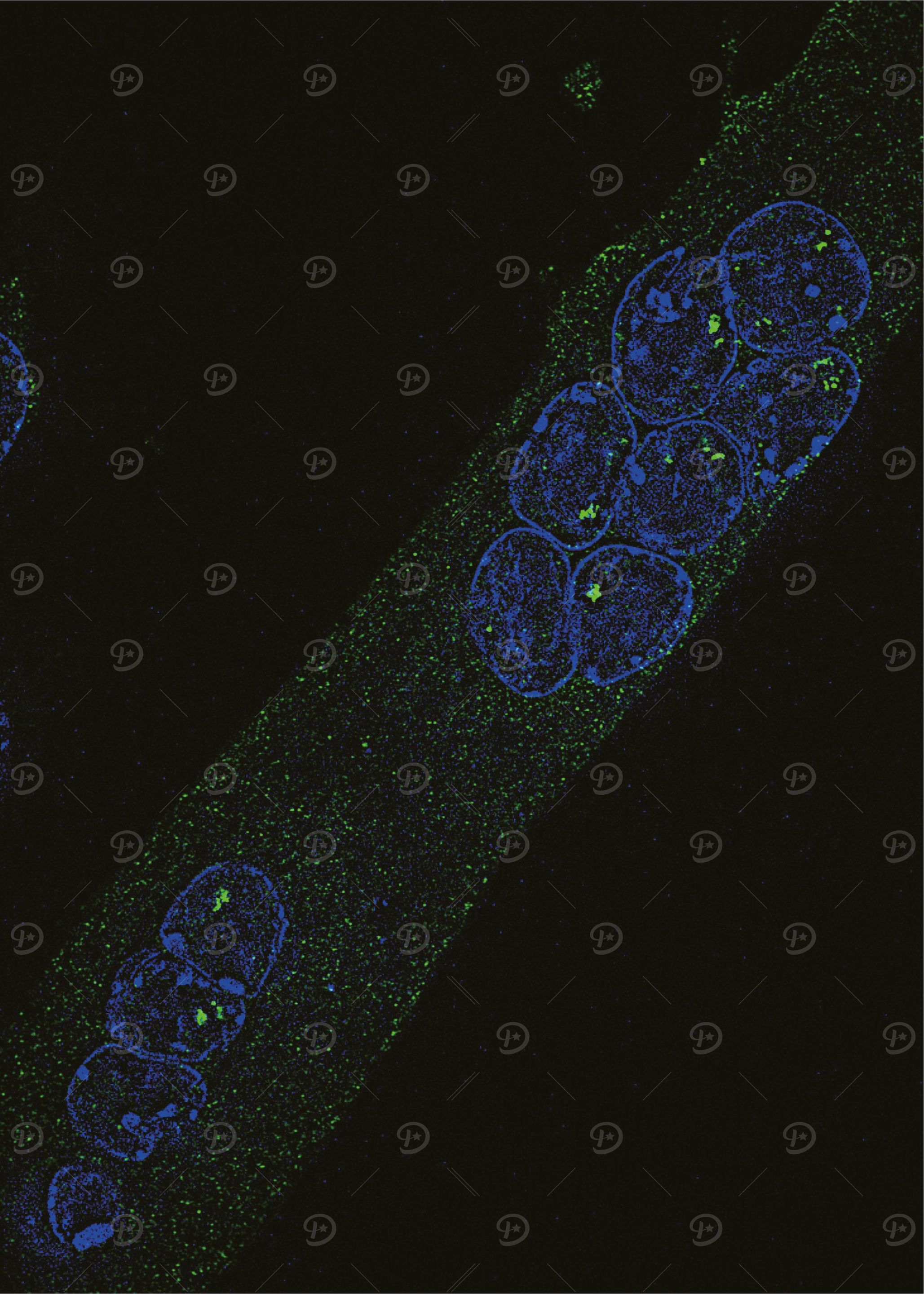 Chromatin Accessibility