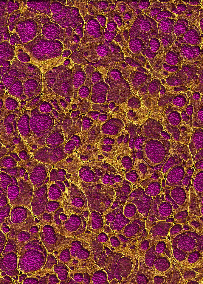 Golden Marble 13