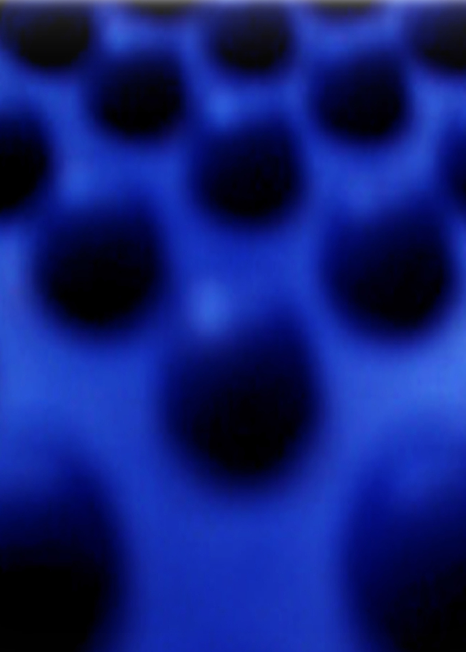 Blue Bumps Up