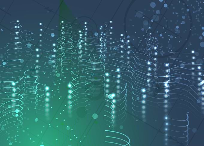 Neural network