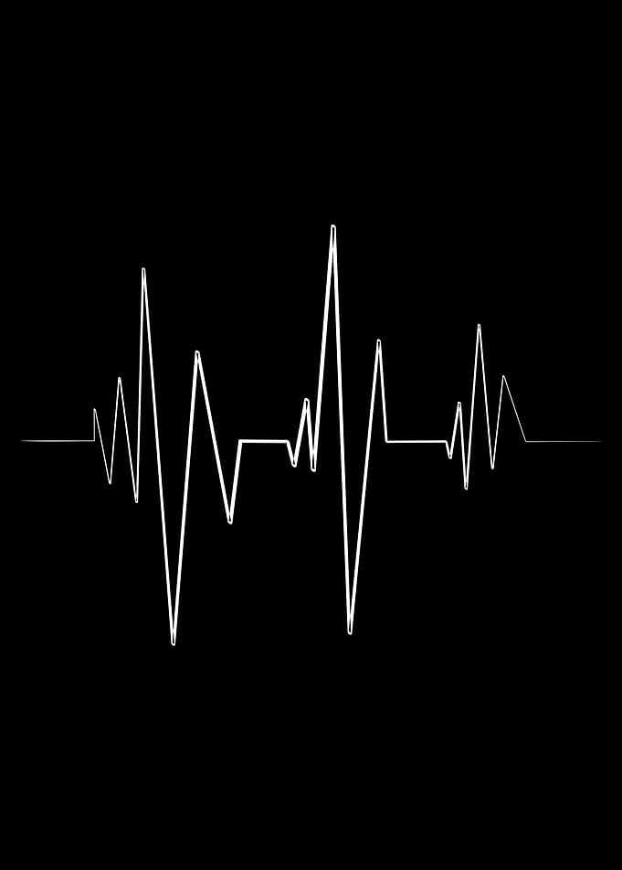ecg monitor