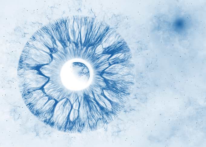 X ray iris