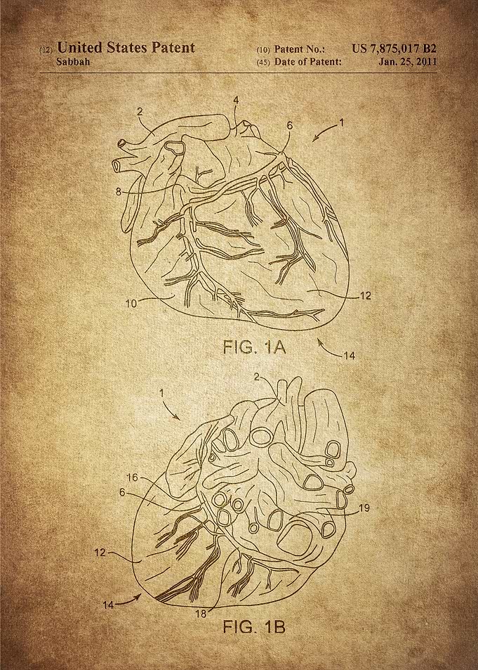 Patent