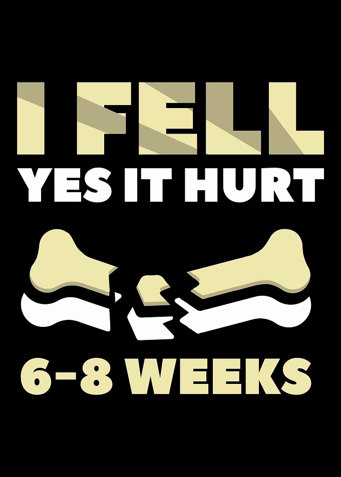 Broken Bones Arms