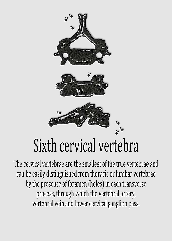 Sixth cervical vertebra
