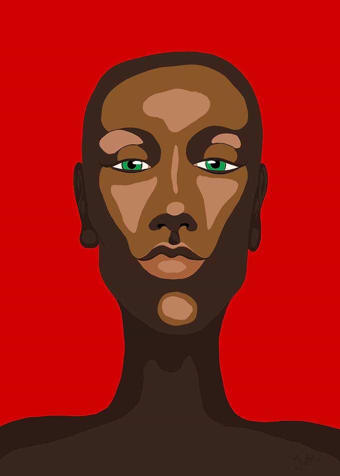 Bald woman