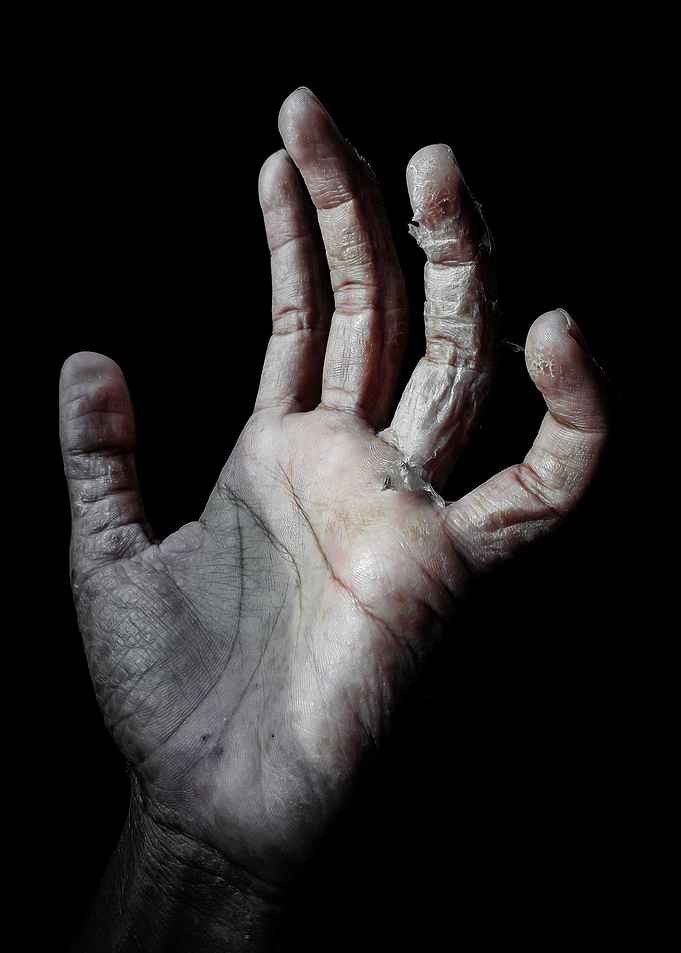 Reaching out for help