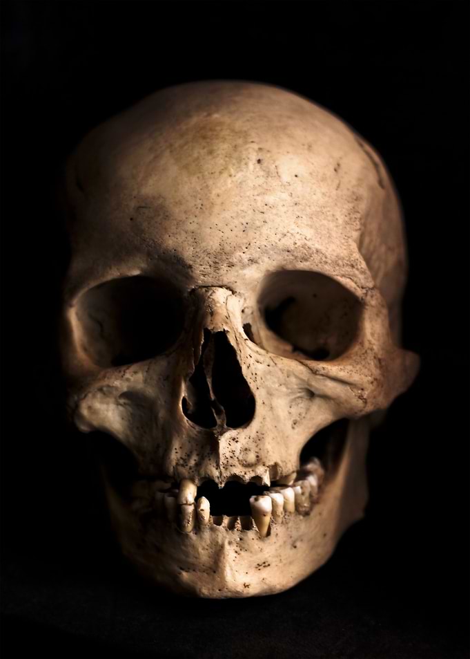 Skull