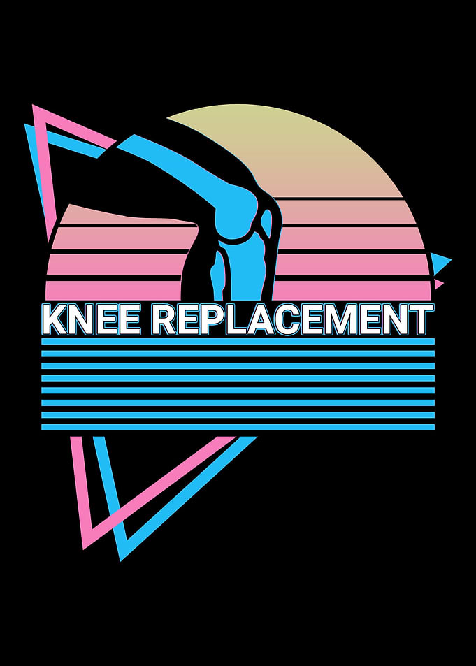 Knee Replacement Retro