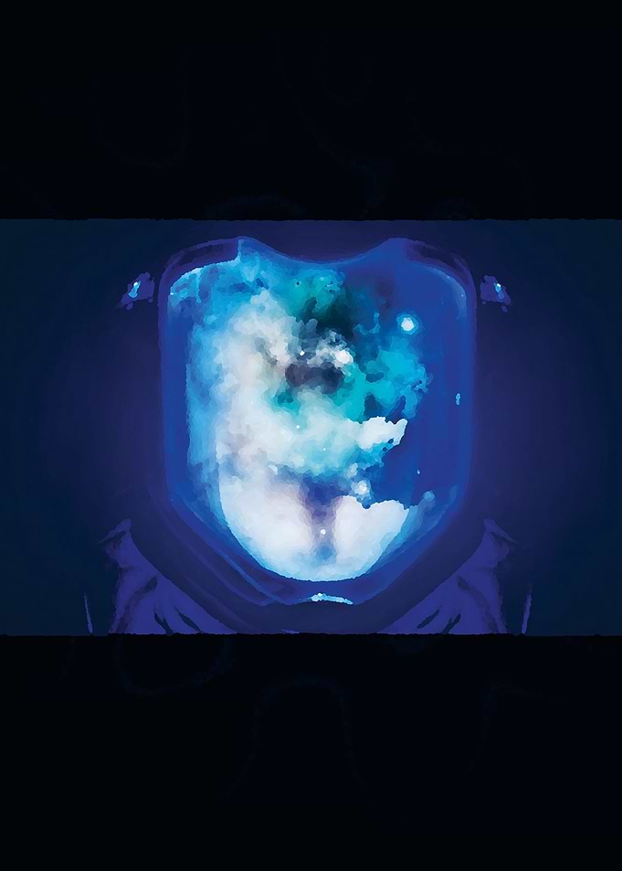 STARSET Transmissions
