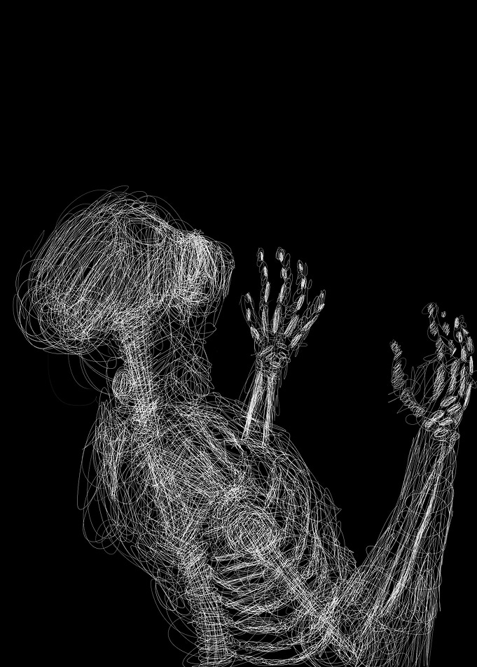 Skeletalis